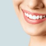 Common Chipped Tooth Treatment Options